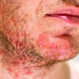 Hereford Beauty Blog March 20